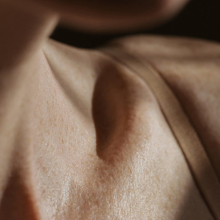 Does Exercise Cause Hair Loss?