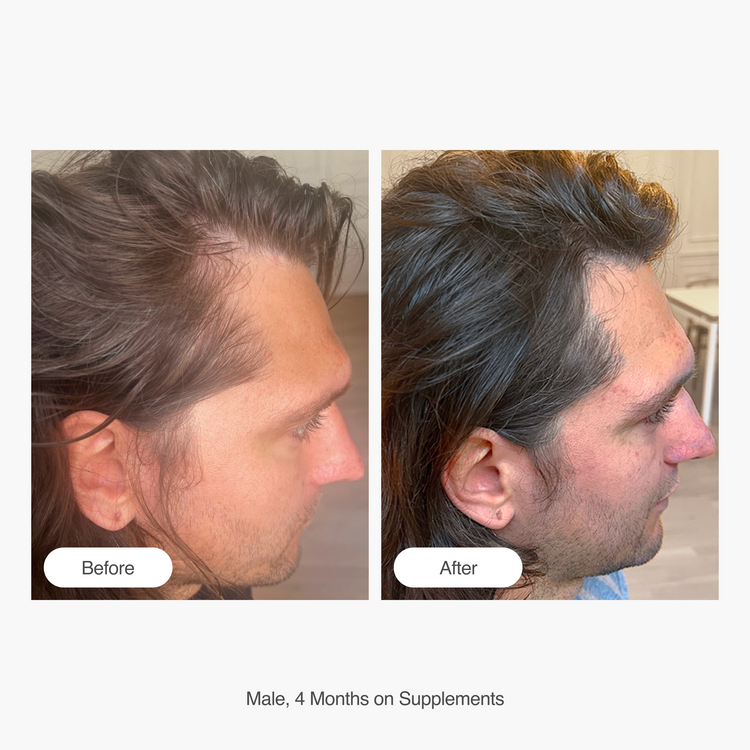 Hair Supplement