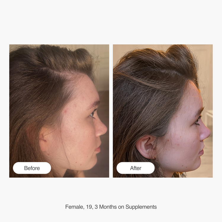 Hair Supplement