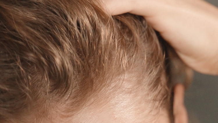 Hair Shedding and Hair Thinning: The Difference